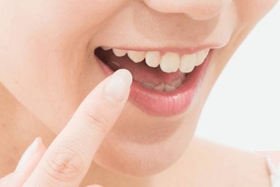 詰め物・被せ物