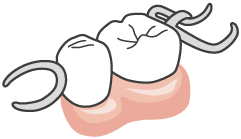 入れ歯